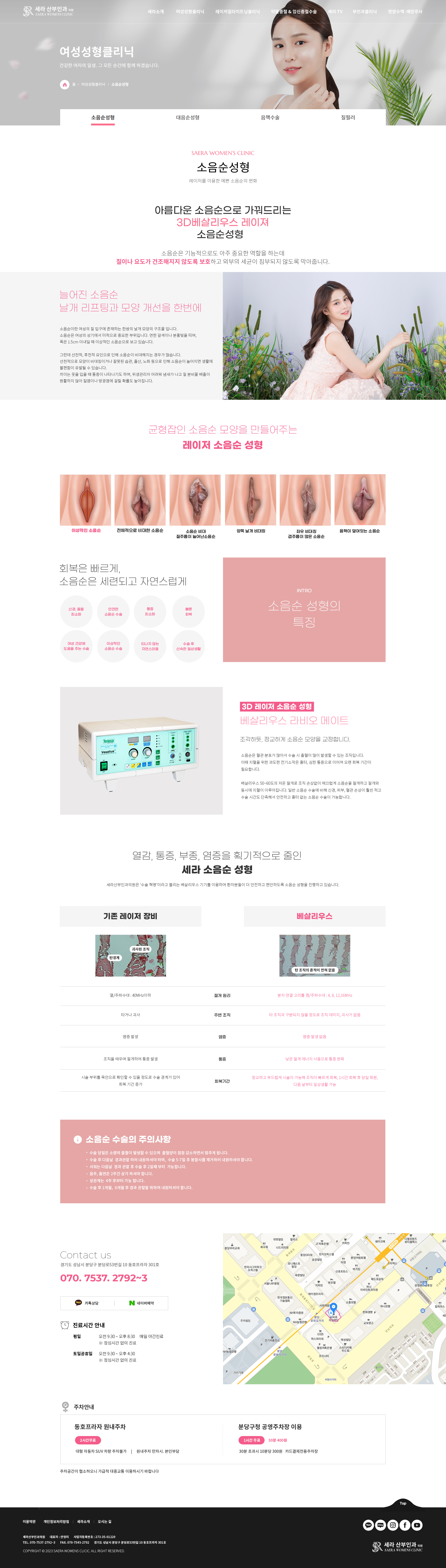 세라산부인과 소음순성형 화면